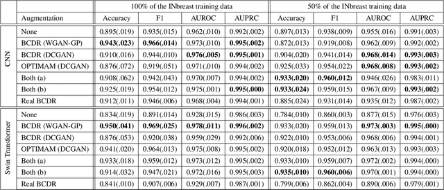 Figure 4 for Sharing Generative Models Instead of Private Data: A Simulation Study on Mammography Patch Classification