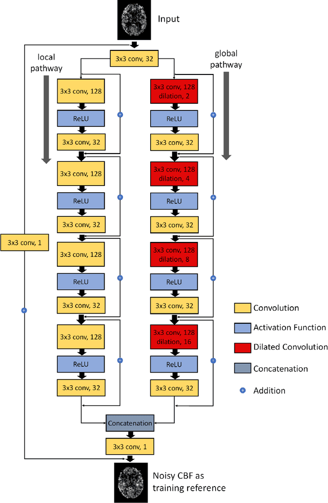 Figure 1 for A Learning-from-noise Dilated Wide Activation Network for denoising Arterial Spin Labeling (ASL) Perfusion Images