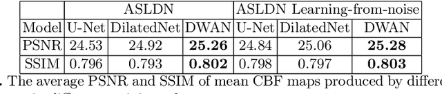 Figure 2 for A Learning-from-noise Dilated Wide Activation Network for denoising Arterial Spin Labeling (ASL) Perfusion Images