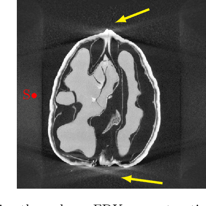 Figure 1 for A Cone-Beam X-Ray CT Data Collection Designed for Machine Learning