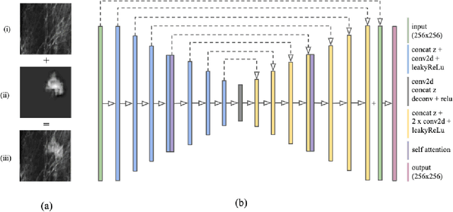 Figure 3 for Synthesizing lesions using contextual GANs improves breast cancer classification on mammograms