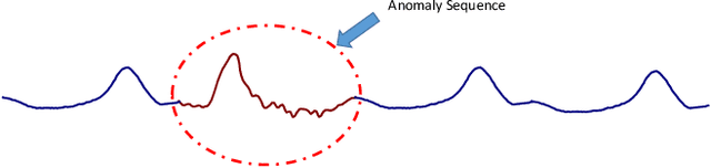 Figure 1 for Time Series Anomaly Detection with Variational Autoencoders