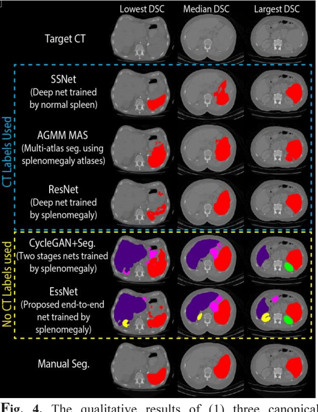 Figure 4 for Adversarial Synthesis Learning Enables Segmentation Without Target Modality Ground Truth