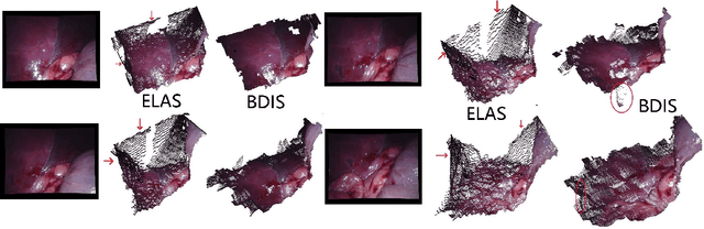 Figure 3 for BDIS: Bayesian Dense Inverse Searching Method for Real-Time Stereo Surgical Image Matching