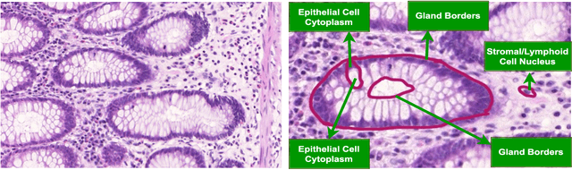 Figure 1 for Nuclei & Glands Instance Segmentation in Histology Images: A Narrative Review