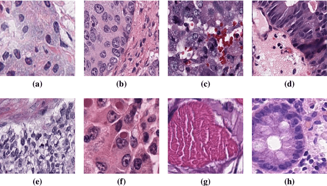 Figure 2 for Nuclei & Glands Instance Segmentation in Histology Images: A Narrative Review