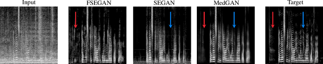 Figure 4 for Perceptual Speech Enhancement via Generative Adversarial Networks