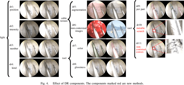 Figure 4 for MBAPose: Mask and Bounding-Box Aware Pose Estimation of Surgical Instruments with Photorealistic Domain Randomization