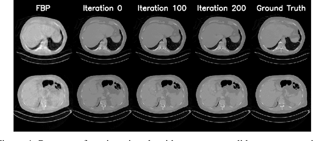 Figure 4 for Generative Tomography Reconstruction