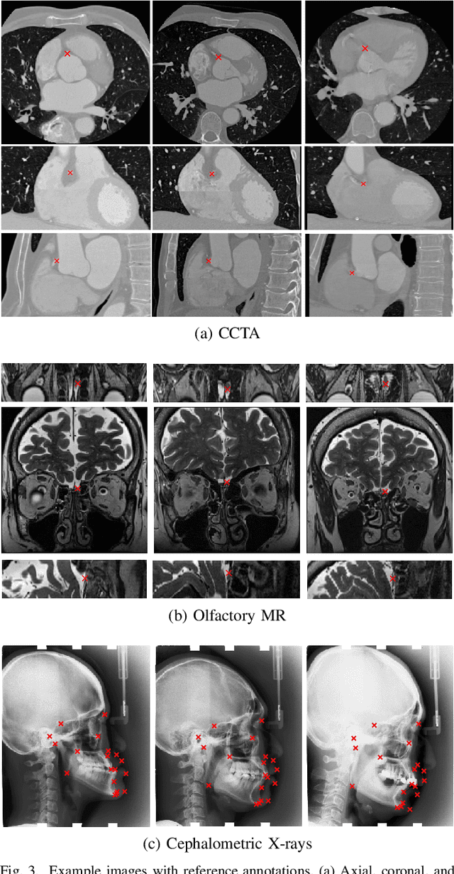 Figure 3 for Deep Learning-Based Regression and Classification for Automatic Landmark Localization in Medical Images