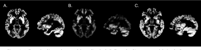 Figure 3 for Visualization approach to assess the robustness of neural networks for medical image classification