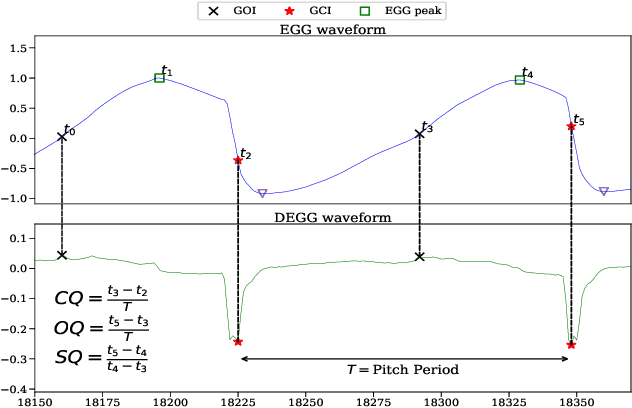 Figure 1 for Adversarial Approximate Inference for Speech to Electroglottograph Conversion