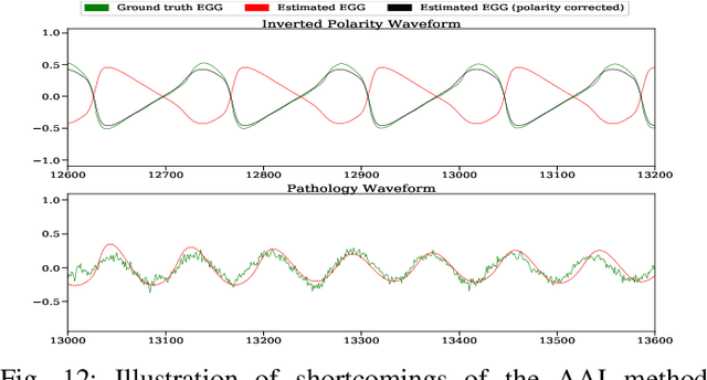 Figure 4 for Adversarial Approximate Inference for Speech to Electroglottograph Conversion