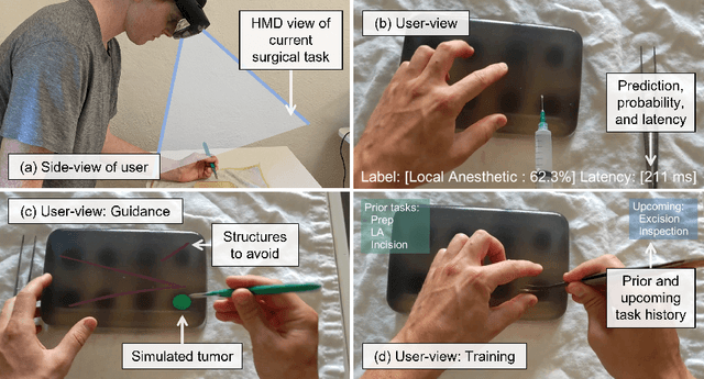 Figure 1 for SurgeonAssist-Net: Towards Context-Aware Head-Mounted Display-Based Augmented Reality for Surgical Guidance