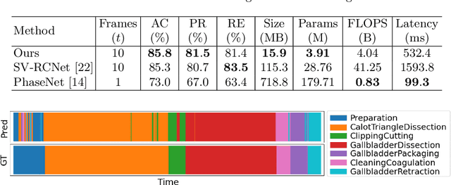 Figure 4 for SurgeonAssist-Net: Towards Context-Aware Head-Mounted Display-Based Augmented Reality for Surgical Guidance