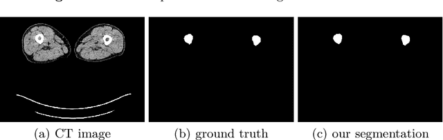 Figure 3 for Towards whole-body CT Bone Segmentation