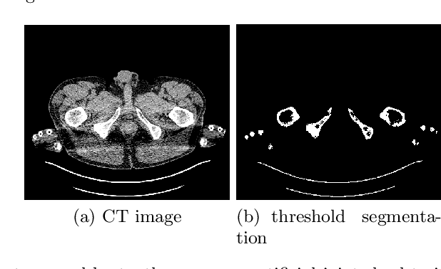 Figure 4 for Towards whole-body CT Bone Segmentation