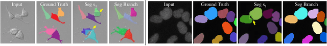 Figure 3 for Multi-scale Cell Instance Segmentation with Keypoint Graph based Bounding Boxes