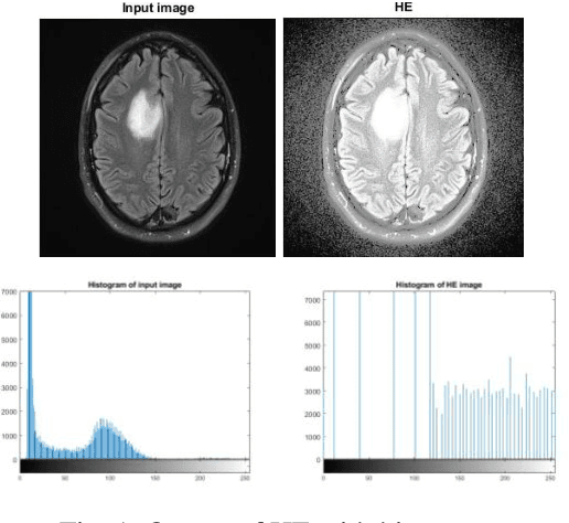 Figure 1 for Medical Image Enhancement Using Histogram Processing and Feature Extraction for Cancer Classification