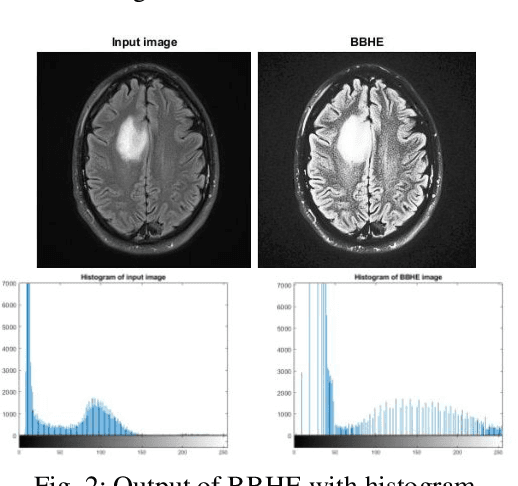 Figure 3 for Medical Image Enhancement Using Histogram Processing and Feature Extraction for Cancer Classification