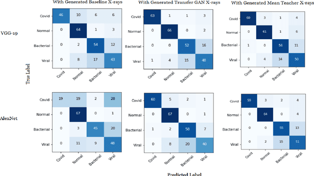 Figure 2 for Generating Realistic COVID19 X-rays with a Mean Teacher + Transfer Learning GAN