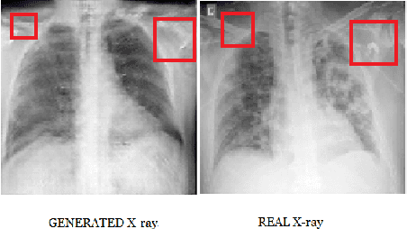 Figure 3 for Generating Realistic COVID19 X-rays with a Mean Teacher + Transfer Learning GAN