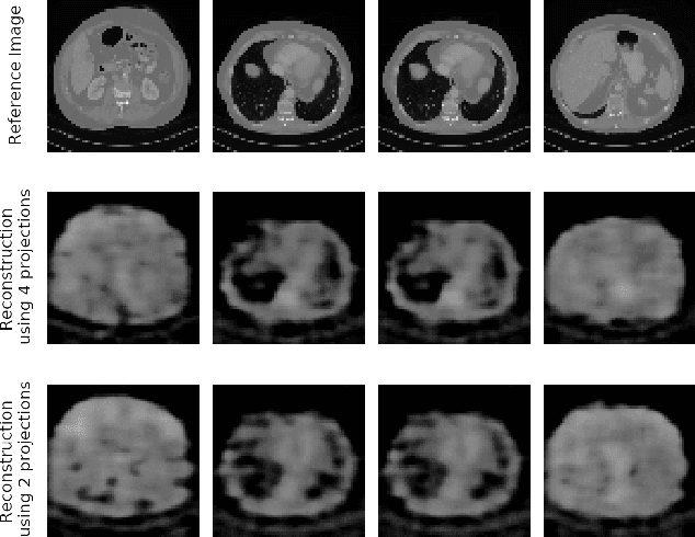 Figure 3 for Robustness Investigation on Deep Learning CT Reconstruction for Real-Time Dose Optimization