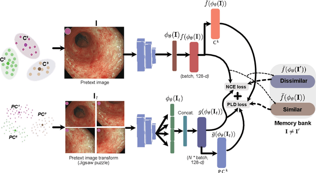 Figure 1 for Patch-level instance-group discrimination with pretext-invariant learning for colitis scoring