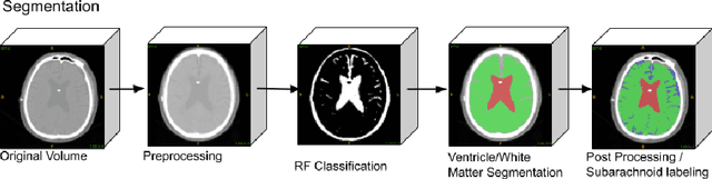 Figure 1 for Fully Automated Volumetric Classification in CT Scans for Diagnosis and Analysis of Normal Pressure Hydrocephalus