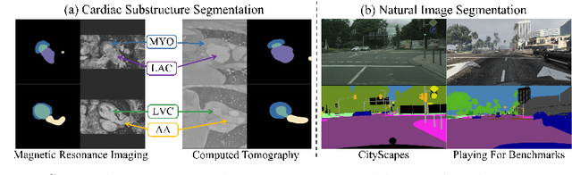 Figure 1 for Mind The Gap: Alleviating Local Imbalance for Unsupervised Cross-Modality Medical Image Segmentation