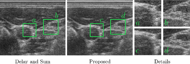 Figure 1 for End-to-End Learning-Based Ultrasound Reconstruction