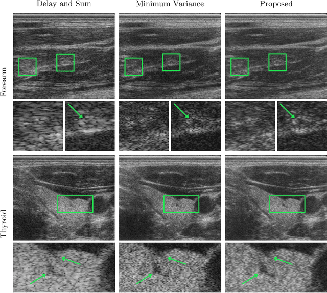 Figure 3 for End-to-End Learning-Based Ultrasound Reconstruction