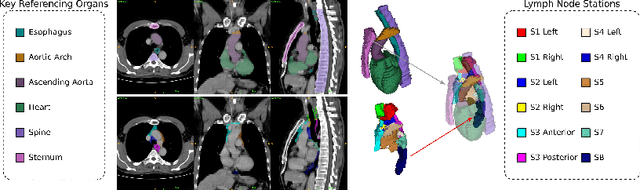 Figure 1 for DeepStationing: Thoracic Lymph Node Station Parsing in CT Scans using Anatomical Context Encoding and Key Organ Auto-Search