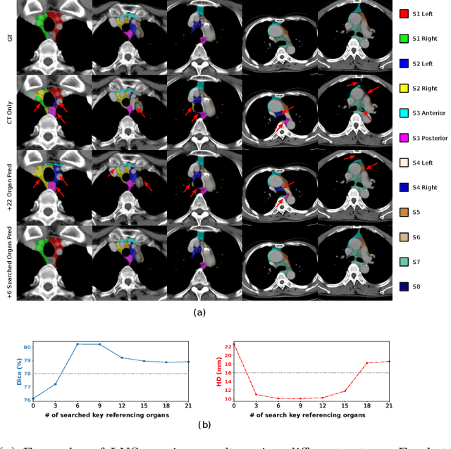 Figure 4 for DeepStationing: Thoracic Lymph Node Station Parsing in CT Scans using Anatomical Context Encoding and Key Organ Auto-Search