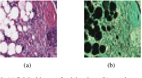 Figure 1 for A modified Bayesian Convolutional Neural Network for Breast Histopathology Image Classification and Uncertainty Quantification