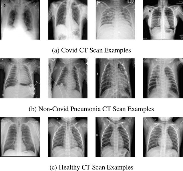 Figure 1 for When Accuracy Meets Privacy: Two-Stage Federated Transfer Learning Framework in Classification of Medical Images on Limited Data: A COVID-19 Case Study