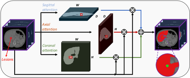 Figure 3 for APAUNet: Axis Projection Attention UNet for Small Target in 3D Medical Segmentation