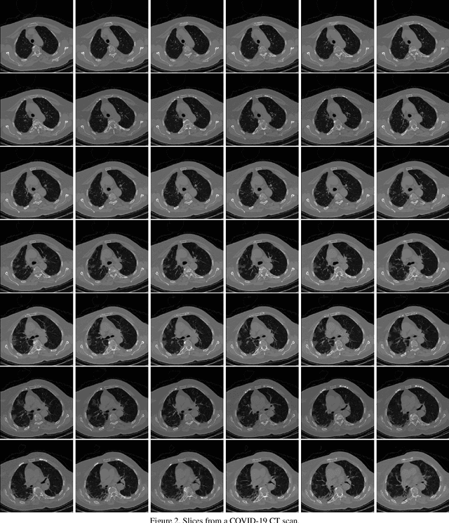 Figure 2 for MIA-COV19D: COVID-19 Detection through 3-D Chest CT Image Analysis