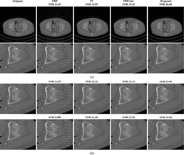 Figure 2 for CNN-Based Projected Gradient Descent for Consistent Image Reconstruction