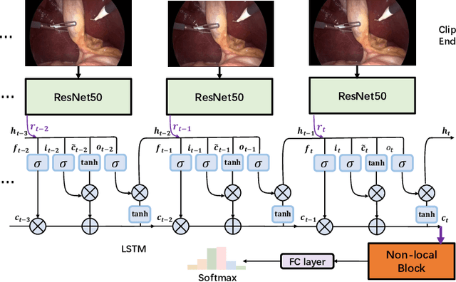 Figure 1 for LRTD: Long-Range Temporal Dependency based Active Learning for Surgical Workflow Recognition