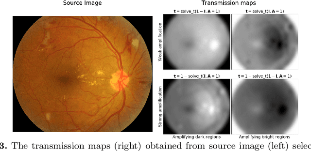 Figure 4 for Enhancement of Retinal Fundus Images via Pixel Color Amplification
