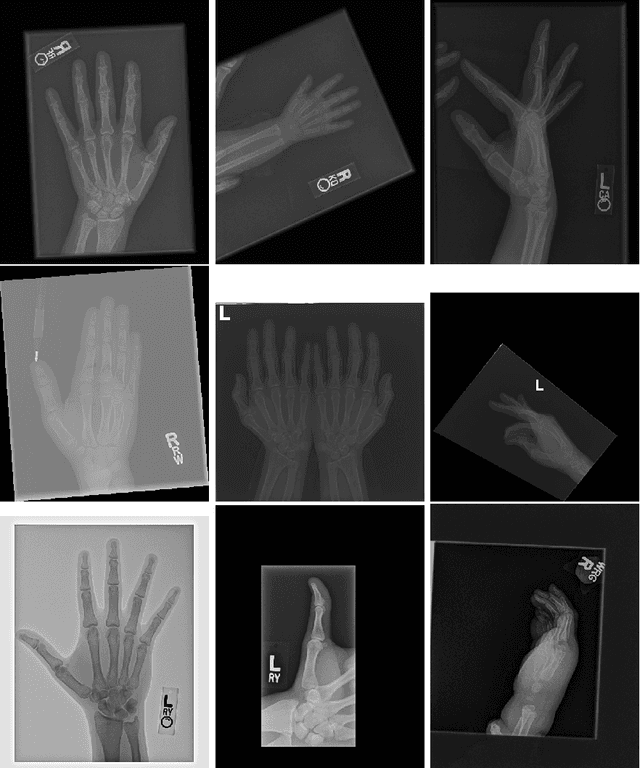 Figure 1 for Unsupervised Anomaly Detection for X-Ray Images