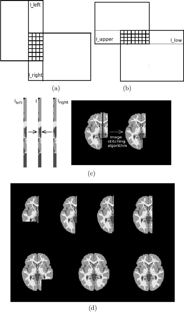 Figure 2 for Local semi-supervised approach to brain tissue classification in child brain MRI