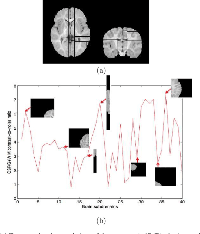 Figure 3 for Local semi-supervised approach to brain tissue classification in child brain MRI