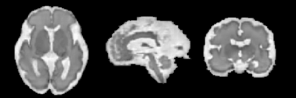 Figure 3 for Synthetic magnetic resonance images for domain adaptation: Application to fetal brain tissue segmentation