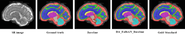 Figure 4 for Synthetic magnetic resonance images for domain adaptation: Application to fetal brain tissue segmentation