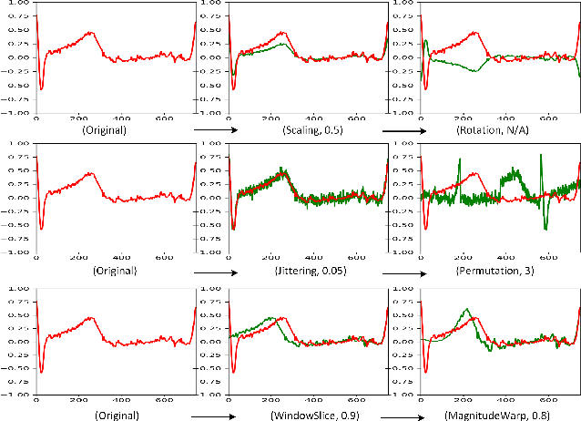 Figure 3 for Empirical Evaluation of Data Augmentations for Biobehavioral Time Series Data with Deep Learning