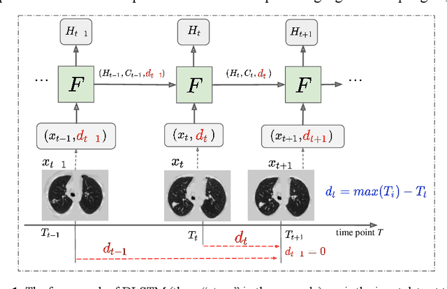 Figure 1 for Distanced LSTM: Time-Distanced Gates in Long Short-Term Memory Models for Lung Cancer Detection