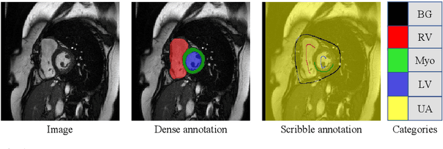 Figure 1 for Scribble-Supervised Medical Image Segmentation via Dual-Branch Network and Dynamically Mixed Pseudo Labels Supervision