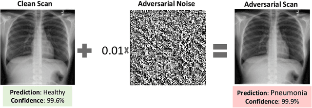 Figure 1 for The Security of Deep Learning Defences for Medical Imaging